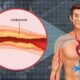 Rahasia Menjaga Kolesterol Tetap Seimbang demi Tubuh Sehat | Sumber: Nutrive Benecol