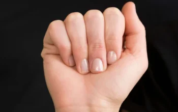 5 Tanda Gangguan Kesehatan yang Bisa Terlihat dari Kuku
