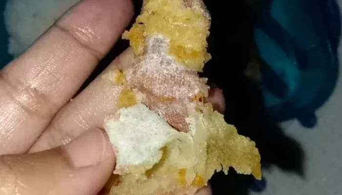 Viral! Plester Bekas Terselip di Tahu Goreng Program Makan Bergizi Gratis di Sukabumi