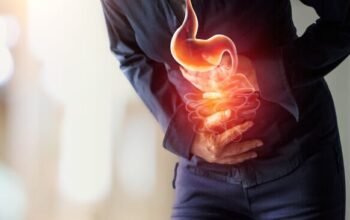 Jangan Salah, Rasa Tidak Nyaman di Perut Belum Tentu Maag, Kenali Dispepsia