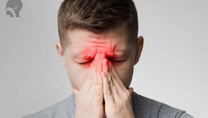 Hidung Tersumbat Tak Kunjung Sembuh? Waspadai Sinusitis