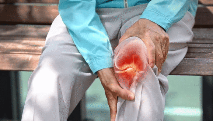 Pengapuran Tulang: Penyebab, Gejala, dan Cara Atasi